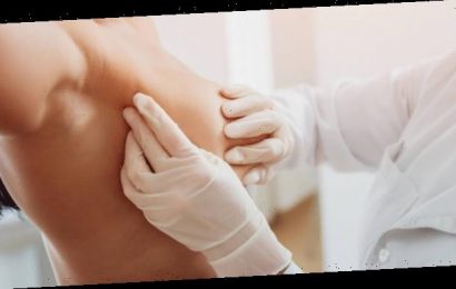 Was steckt hinter dem Tamoxifen-Engpass?